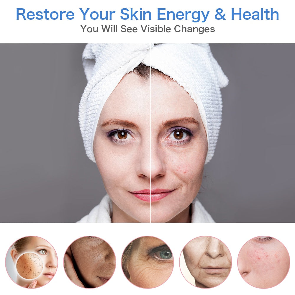 Electroporation LED Photon Facial RF Radio Frequency Skin Rejuvenation EMS Mesotherapy for Tighten Face Lift Beauty Treatment