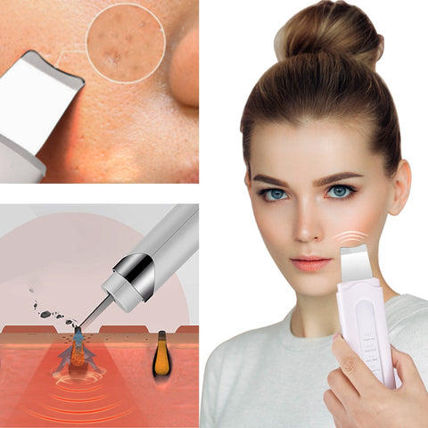 Image of Ultrasonic Skin Scrubber Ultrasound Ion Deep Facial Cleansing Machine Remove Blackhead Wrinkle Pore Clean Face Vibrator Massage